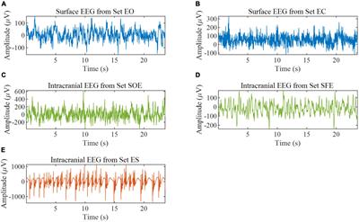 A novel multi-feature fusion attention neural network for the recognition of epileptic EEG signals